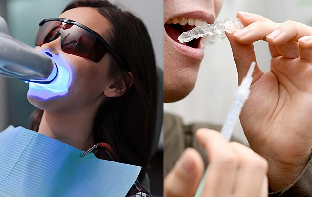 ホワイトニング